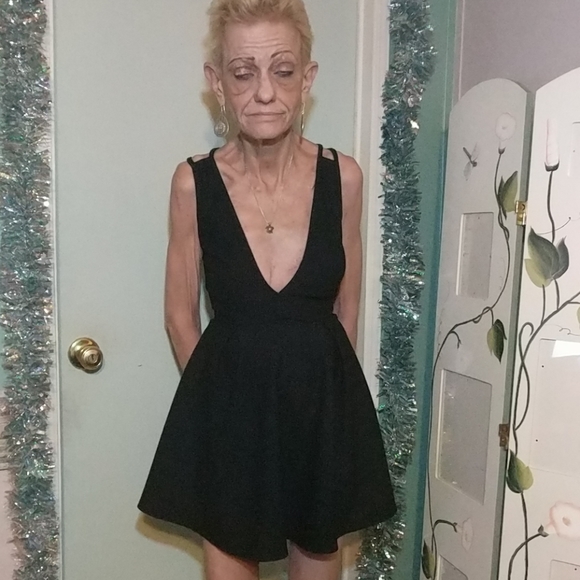 Windsor Dresses & Skirts - Windsor LBD with strappy back size S